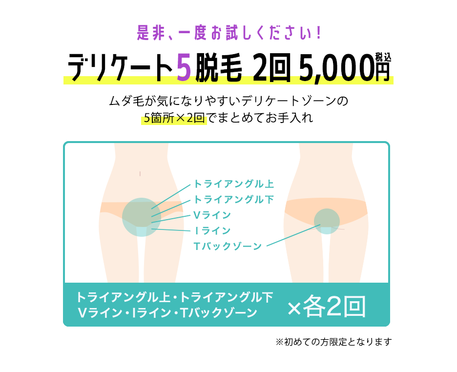 ぜひ一度お試しください! デリケート5脱毛 5000円 5か所×2回 トライアングル上・トライアングル下・Vライン・Iライン・Tバックゾーン