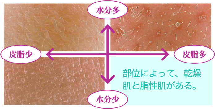 部位によって乾燥肌と脂性肌がある。