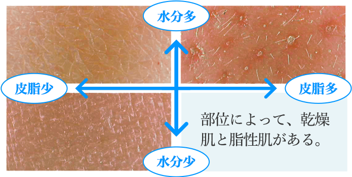 部位によって乾燥肌と脂性肌がある。