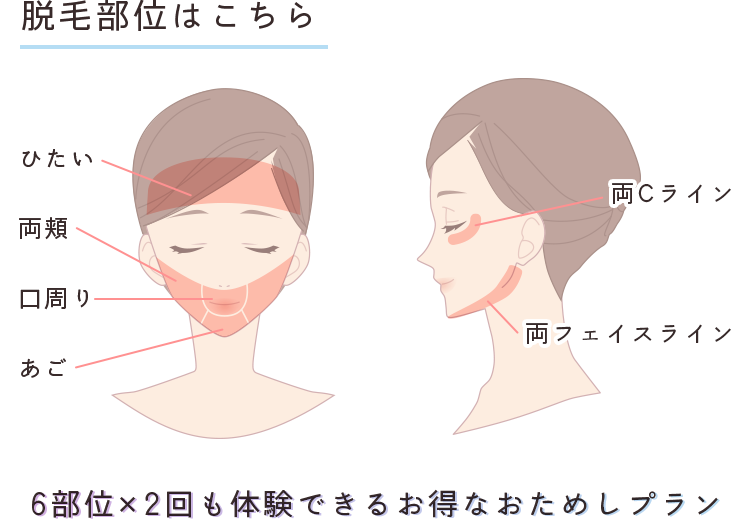 脱毛部位はこちら ひたい・両頬・口周り・あご・両Cライン・両フェイスライン 6部位×2回も体験できるお得なおためしプラン