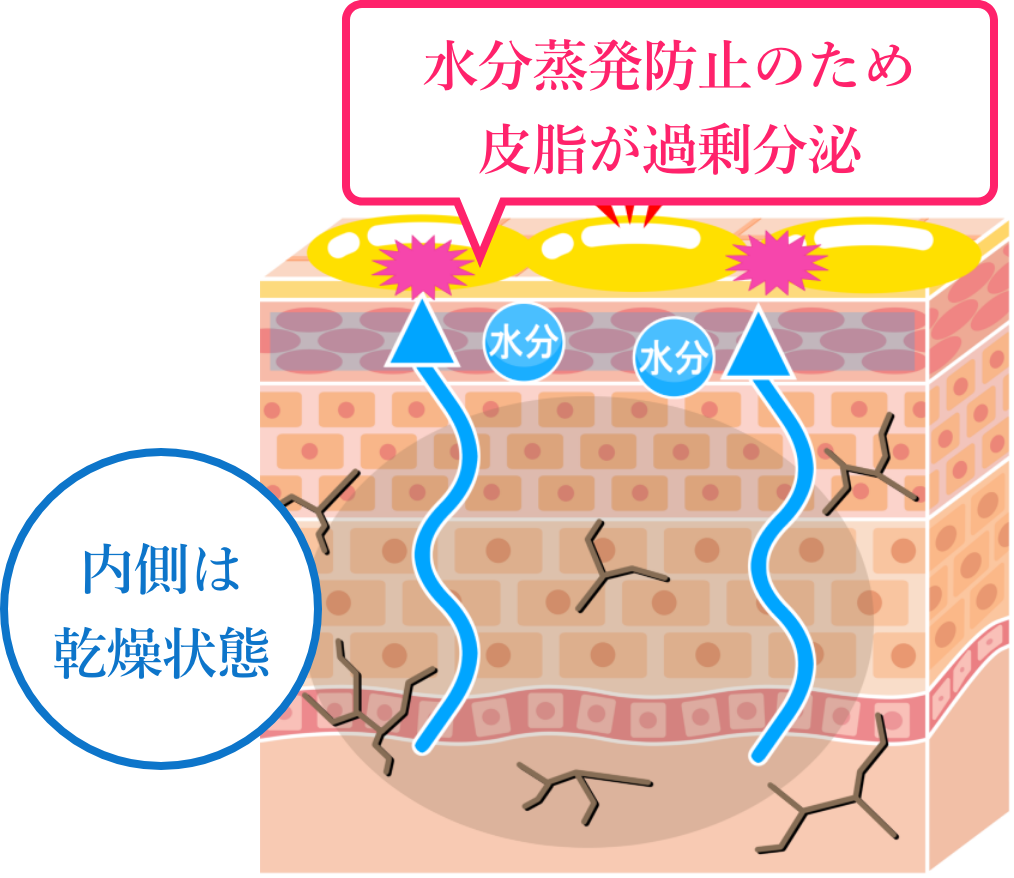 水分蒸発防止のため皮脂が過剰分泌　内側は乾燥状態　イメージ