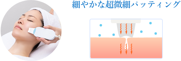 細やかな超微細パッティング