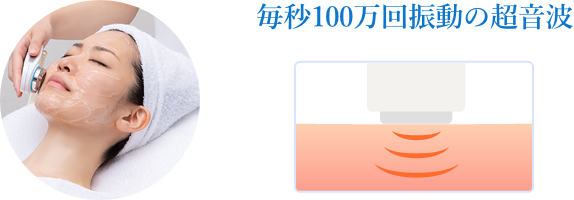 毎秒100万回振動の超音波