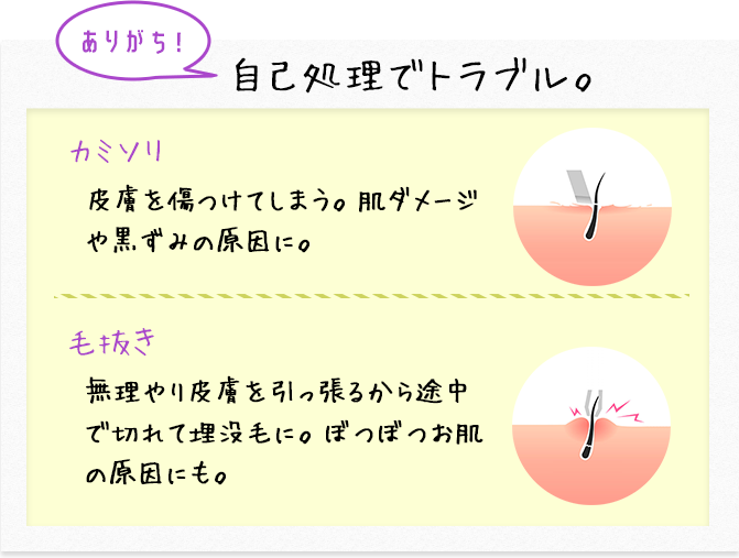 自己処理でトラブル。カミソリ 毛抜き