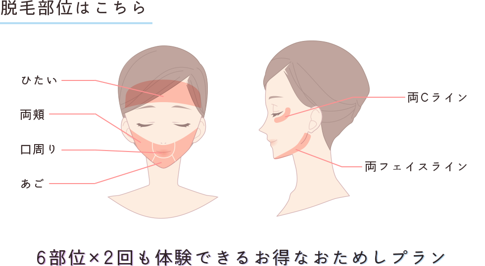 脱毛部位はこちら ひたい・両頬・口周り・あご・両Cライン・両フェイスライン 6部位×2回も体験できるお得なおためしプラン